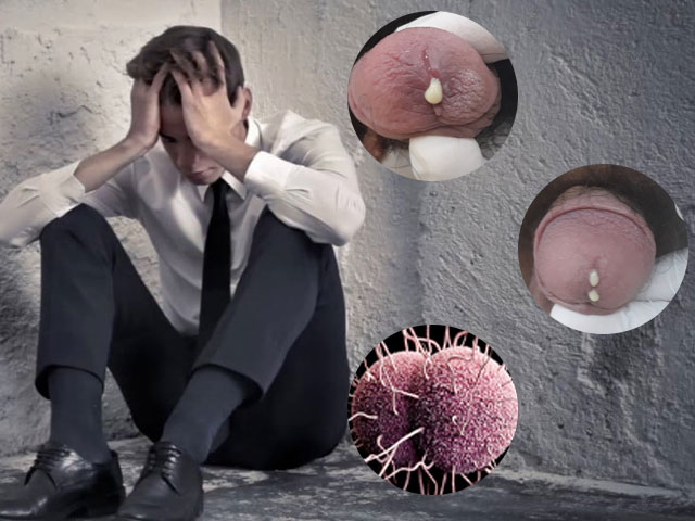 Điều trị bệnh lậu